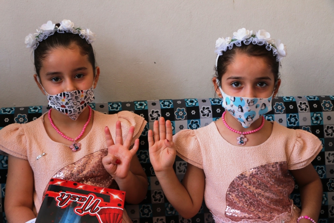 Adıyaman'da doğan Türkiye ve Suriye' adlı ikizler ilgi çekiyor
