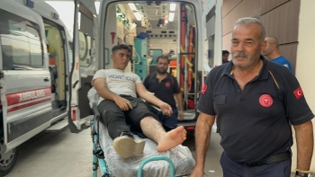 Adıyaman’da otomobille motosiklet çarpıştı: 1 yaralı