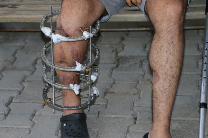 Adıyamanlı çiğköfteci Antalya'da yaşadığı silahlı saldırıyı anlattı: 'Can güvenliğim tehlikede' - Videolu Haber